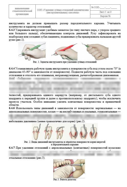 СОП «Удаление зубных  отложений механическим (инструментальным) способом»